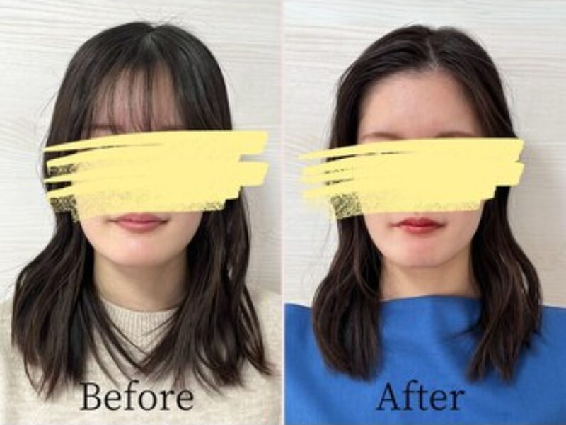 【お客様レポート】顔タイプ診断とは？